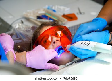 A Scared Looking Little Girl Looks At Her Dentist With Wide Eyes As She Has An LED Light Curing New Seals On Her Teeth.