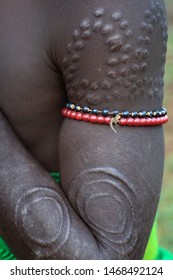 Scarification on the upper arm of a young Mursi warrior, Ethiopia