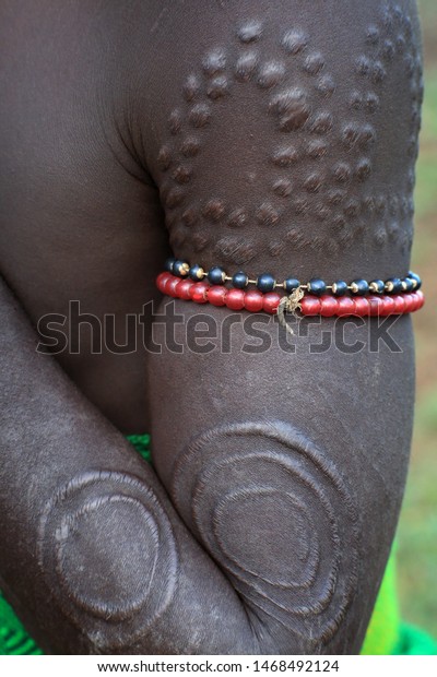 Scarification on the upper arm of a young Mursi\
warrior, Ethiopia
