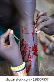 Scarification With A Razor Blade, Suri Tribe, Ethiopia