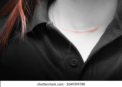 Scars On Woman's Neck From Thyroid Surgery