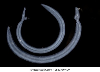 Schistosoma Images Stock Photos Vectors Shutterstock