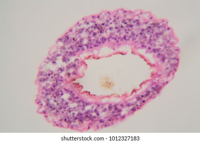 Schistosoma mansoni under the microscope. Schistosoma mansoni is human parasite and causes schistosomiasis.