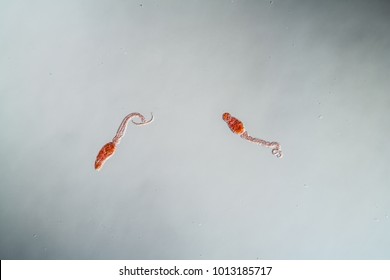 Schistosomiasis Hd Stock Images Shutterstock