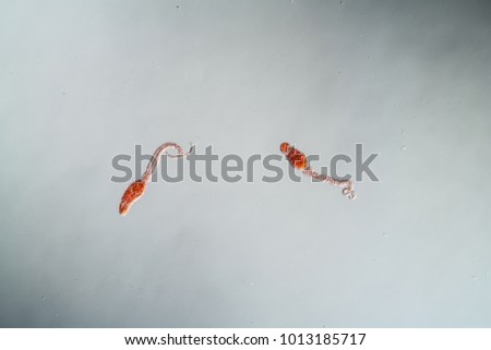 Schistosomiasis pathogens under the microscope