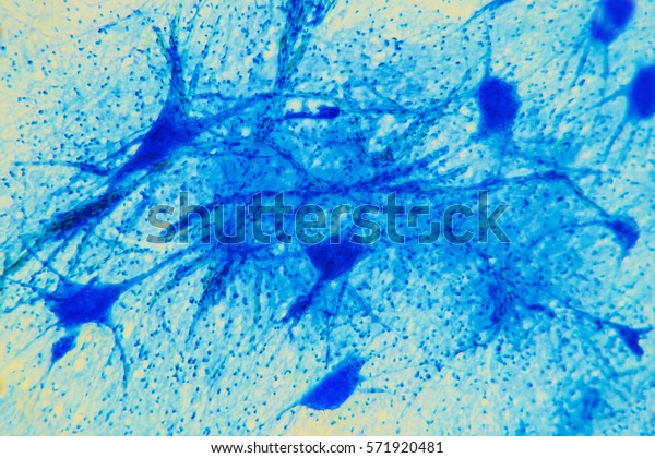 Science\
background- neuron tissue. Nerve fibers: motor neurous- study with\
a large increase in the structural and functional nerve system.\
Core cell body processes. Scientific- spinal\
cord