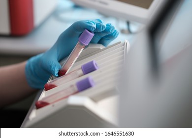 Science Concept. Laboratory Research And Development. Scientific Glassware For Chemical Experiment. Female Scientist Working With Microscope, Laboratory Beakers, Test Tubes, Pipettes. Lab Interior.
