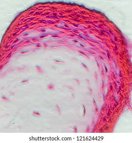 Science Micrograph Of Bone Cell Osteocyte