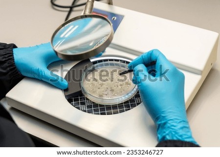Scientist analysis and cultivate bacteria molds and fungal testing clinical samples, cultured in petri dish. Growth media to isolate total fungal by using colony counter in laboratory. Foto d'archivio © 