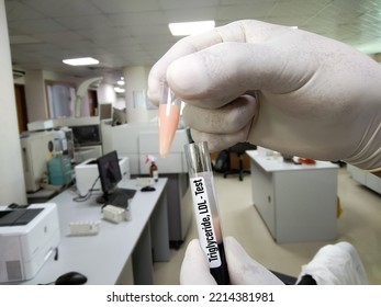 Scientist Or Biochemist Hold Test Tube With Lipemic Blood Sample. High Triglyceride, LDL Contain Blood Sample. Lipid Profile.