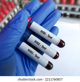 Scientist Blood Samples For Influenza A Virus Subtype H1N1, H1N2 And H1N3 Test.