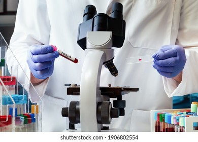 Scientist with blood samples of patient for analysis of test of seroprevalence. Microbiologist with blood tube test and slide for analysis of antibodies for infectious disease Coronavirus virus