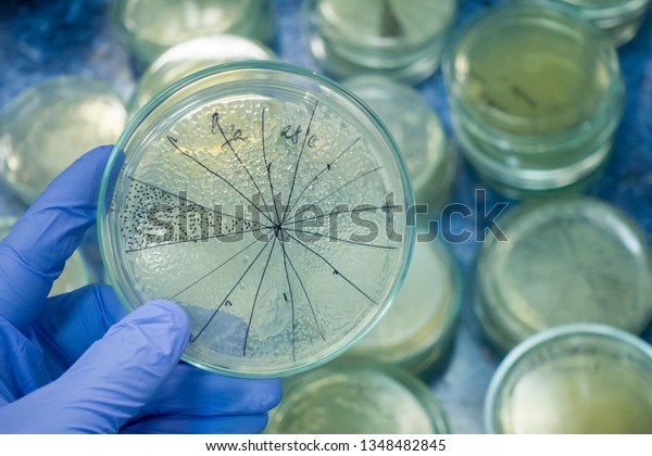 A\
scientist in a blue glove holds a petri dish with bacteria.\
Bacteria from human intestines. Petri dish is highlighted for\
analysis of bacteria. Petri dish divided into\
sectors.