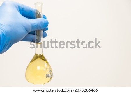 Scientist in blue rubber holding a yellow solution in the flask on the white background with copy space. Urea analysis. Clinical, toxicological and forensic analysis.