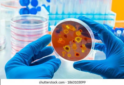 Scientist examines dengue virus on petri dish in laboratory, conceptual image