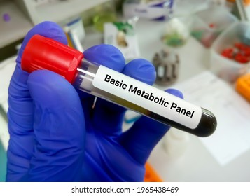 Scientist Hold Blood Sample For Basic Metabolic Panel Test