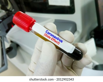 Scientist Hold Blood Sample For Covid-19 Side Effect Test. Post Covid Symptoms