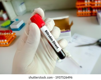 Scientist Hold Blood Sample For Direct Bilirubin Test