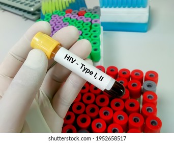 Scientist Hold Blood Sample For HIV Type 1,2 Antibody Testing, Hiv Screening Test