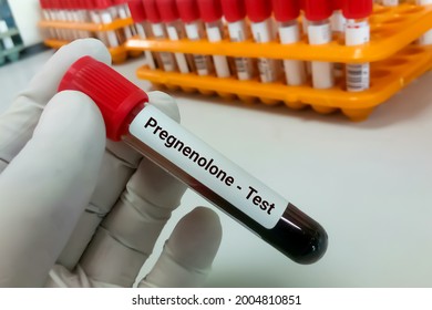 Scientist Hold  Blood Sample For Pregnenolone Test. To Help Detect And Monitor Treatment For Rare Types Of Genetic Conditions Such As Congenital Adrenal Hyperplasia (CAH)