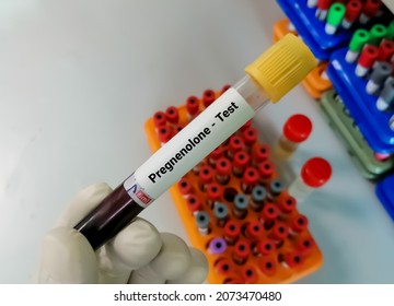 Scientist Hold  Blood Sample For Pregnenolone Test. To Help Detect And Monitor Treatment For Rare Types Of Genetic Conditions Such As Congenital Adrenal Hyperplasia (CAH).