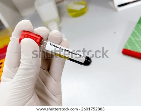 Scientist hold blood sample for Reverse Triiodothyronine (rT3) test. Healthcare and medical test concept.