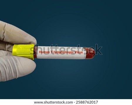 Scientist hold blood sample test tube for Human T lymphotropic Virus test with laboratory background. Healthcare and medical test concept.