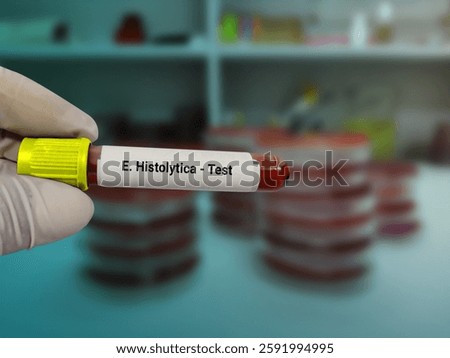 Scientist hold blood sample test tube for  Entamoeba histolytica test with laboratory background. Healthcare and medical test concept.