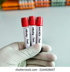 Scientist Hold Blood Samples For Hepatitis Virus Test (Hepatitis B, C And E). HBsAg, HBeAg, Anti HCV.