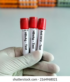 Scientist Hold Blood Samples For Hepatitis Virus Test (Hepatitis B, C And E). HBsAg, HBeAg, Anti HCV.