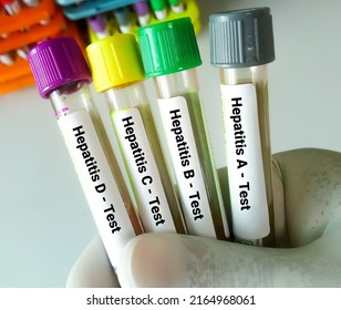 Scientist Hold Blood Samples For Hepatitis Virus Test (Hepatitis A, B, C And D)