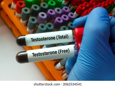 Scientist Hold Test Tubes With Blood Sample For Testosterone (Total And Free) Test. Healthcare Or Medical Concept. Sex Hormone.