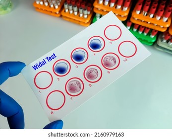 Scientist Hold Testing Plate For Widal Test By Agglutination Method With Lab Background, To Diagnosis Typhoid And Paratyphoid Fever At Laboratory, Salmonella Bacteria Disease Testing