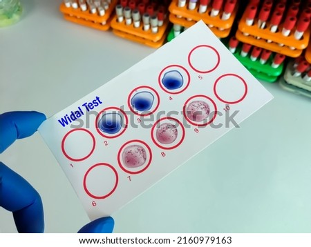 Scientist hold testing plate for Widal test by agglutination method with lab background, to diagnosis Typhoid and Paratyphoid fever at laboratory, Salmonella bacteria disease testing
