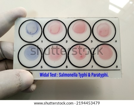 Scientist hold testing plate for Widal test by agglutination method with lab background, to diagnosis Typhoid and Paratyphoid fever at laboratory, Salmonella bacteria disease testing