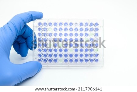 Scientist is holding 96 well micro plate that  tested enzyme linked immunosorbent assay(ELISA) for drug screening in laboratory