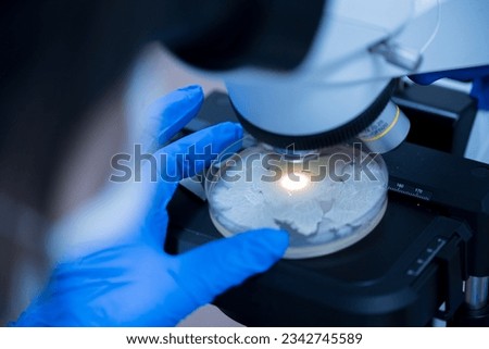 Scientist holding agar plate for diagnosis bacterial or  microorganism, blurry microscopy background at laboratory. Selective petri dish with colonies of bacteria under the lens of a microscope.