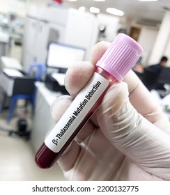 Scientist Holding Blood Sample For Beta Thalassemia Mutation Detection. Hb-electrophoresis. Thalassemia Mutation Testing.