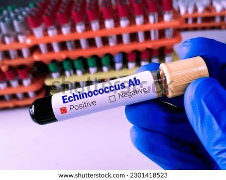 Scientist holding blood sample for Echinococcus Antibody test, Echinococcosis, tapeworms.