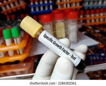 Scientist Holding Blood Sample For Specific Growth Factor Test.