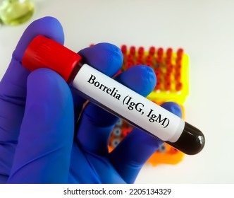 Scientist Holding Blood Sample Tube For Borrelia IgG And IgM Test, Lyme Disease Diagnosis.