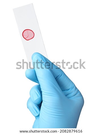 Scientist holding microscope slide with sample on white background, closeup