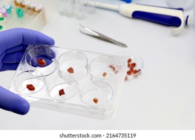 A scientist is holding a multi-well plate with pieces of raw cultured meat in the biotechnology laboratory, Synthetic production, or laboratory-grown meat concept. 