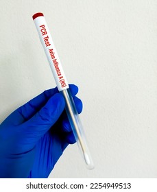 Scientist holding Nasopharyngeal swab for PCR testing of Avian Influenza A (H5). - Shutterstock ID 2254949513