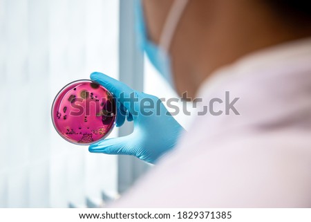 Scientist holding petri dish with bacterial infection (Escherichia coli ) analyzes microorganisms growth. Medical tests in laboratory research disease outbreak control prevention.