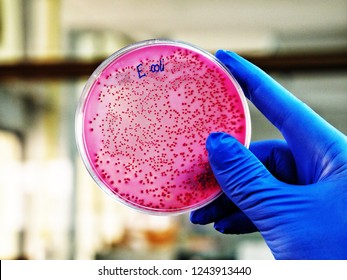 A scientist is holding a plate of E. Coli growing on selective agar media in microbiology laboratory