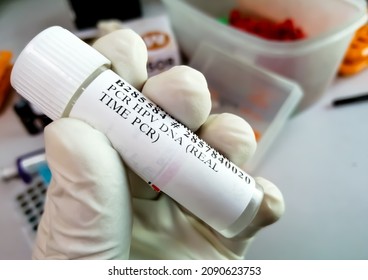 Scientist Holding Sample Container Cervical Fluid Sample For PCR HPV DNA (real Time PCR) Test, Human Papilloma Virus, Cervical Cancer. A Medical Testing Concept In The Laboratory