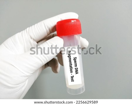 Scientist holding sample container with Sperm for DNA Fragmentation test.