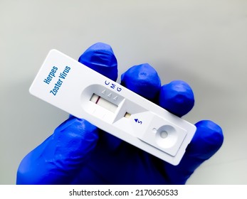Scientist holding test cassette for Herpes Zoster virus rapid screening test.