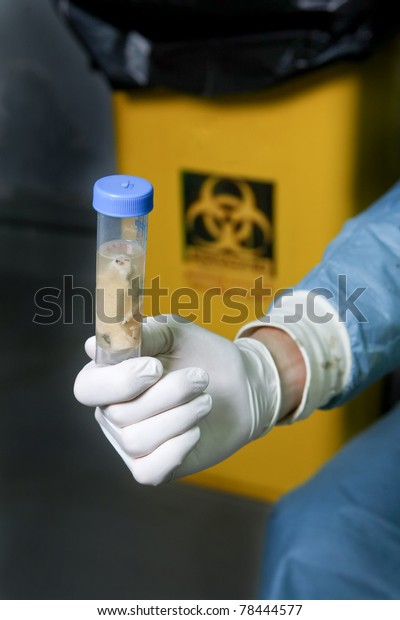 Scientist holds a\
brain sample of mad cow\
disease